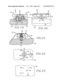 VASCULAR WOUND CLOSING APPARATUS AND METHOD diagram and image