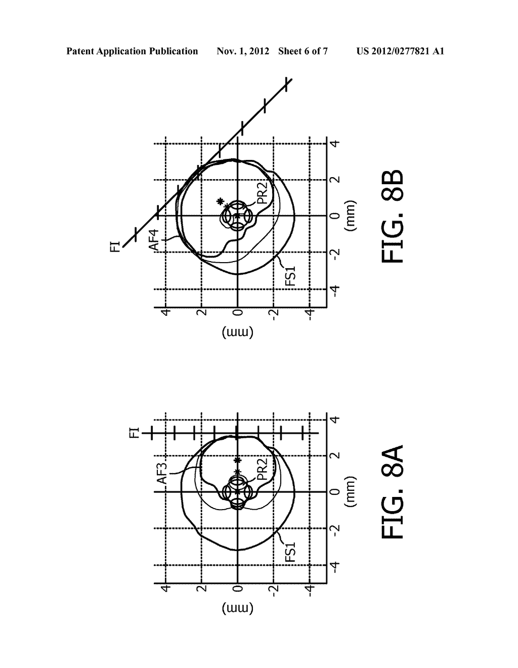 High Resolution Electrical Stimulation Leads - diagram, schematic, and image 07