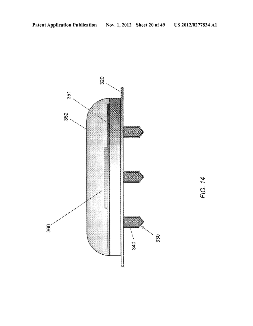 MICROFABRICATED SURFACE NEUROSTIMULATION DEVICE AND METHODS OF MAKING AND     USING THE SAME - diagram, schematic, and image 21