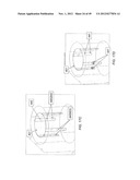 MICROFABRICATED SURFACE NEUROSTIMULATION DEVICE AND METHODS OF MAKING AND     USING THE SAME diagram and image