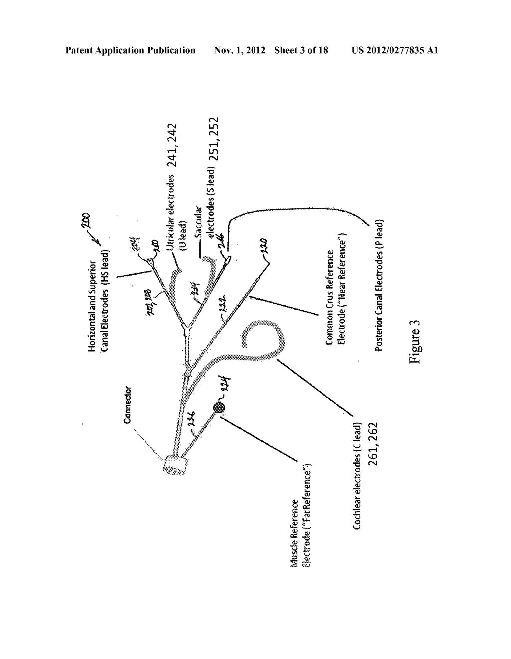 IMPLANTABLE VESTIBULAR PROSTHESIS - diagram, schematic, and image 04