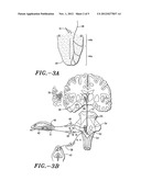 METHOD AND SYSTEM FOR MODULATING EATING BEHAVIOR BY MEANS OF     NEURO-ELECTRICAL CODED SIGNALS diagram and image