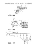 METHOD AND SYSTEM FOR MODULATING EATING BEHAVIOR BY MEANS OF     NEURO-ELECTRICAL CODED SIGNALS diagram and image