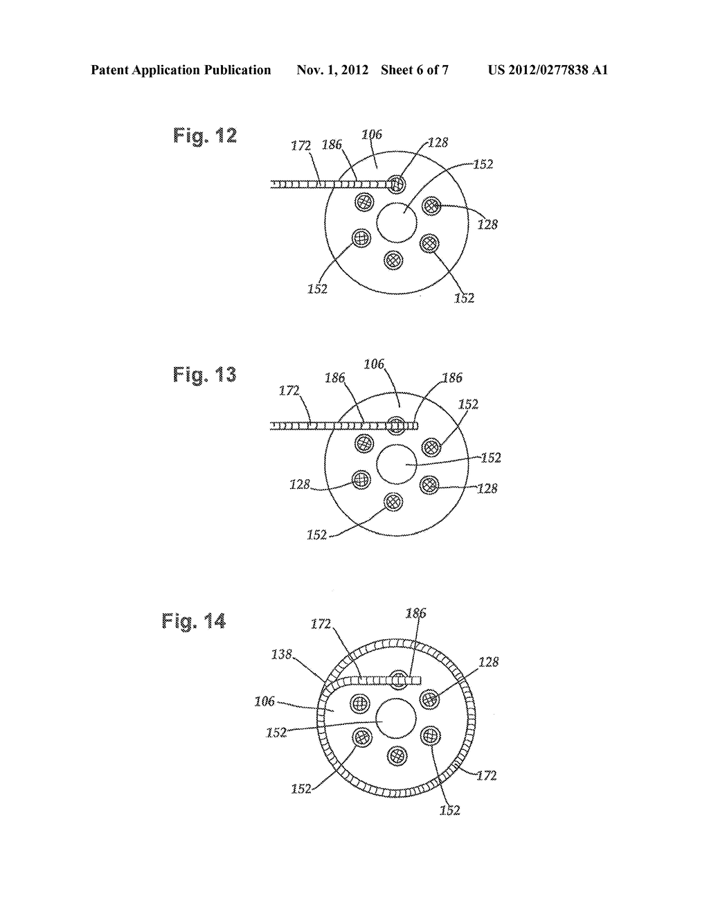 METHOD FOR FABRICATING A NEUROSTIMULATION LEAD CONTACT ARRAY - diagram, schematic, and image 07