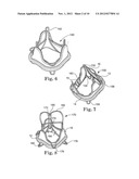 Delivery Systems and Methods of Implantation for Replacement Prosthetic     Heart Valves diagram and image