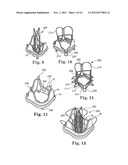 Delivery Systems and Methods of Implantation for Replacement Prosthetic     Heart Valves diagram and image