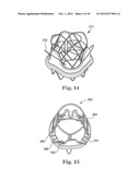 Delivery Systems and Methods of Implantation for Replacement Prosthetic     Heart Valves diagram and image