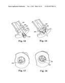 Delivery Systems and Methods of Implantation for Replacement Prosthetic     Heart Valves diagram and image