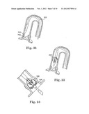 Delivery Systems and Methods of Implantation for Replacement Prosthetic     Heart Valves diagram and image