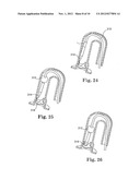 Delivery Systems and Methods of Implantation for Replacement Prosthetic     Heart Valves diagram and image