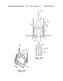 Delivery Systems and Methods of Implantation for Replacement Prosthetic     Heart Valves diagram and image