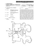 EXPANDABLE SPINAL INTERBODY IMPLANT diagram and image