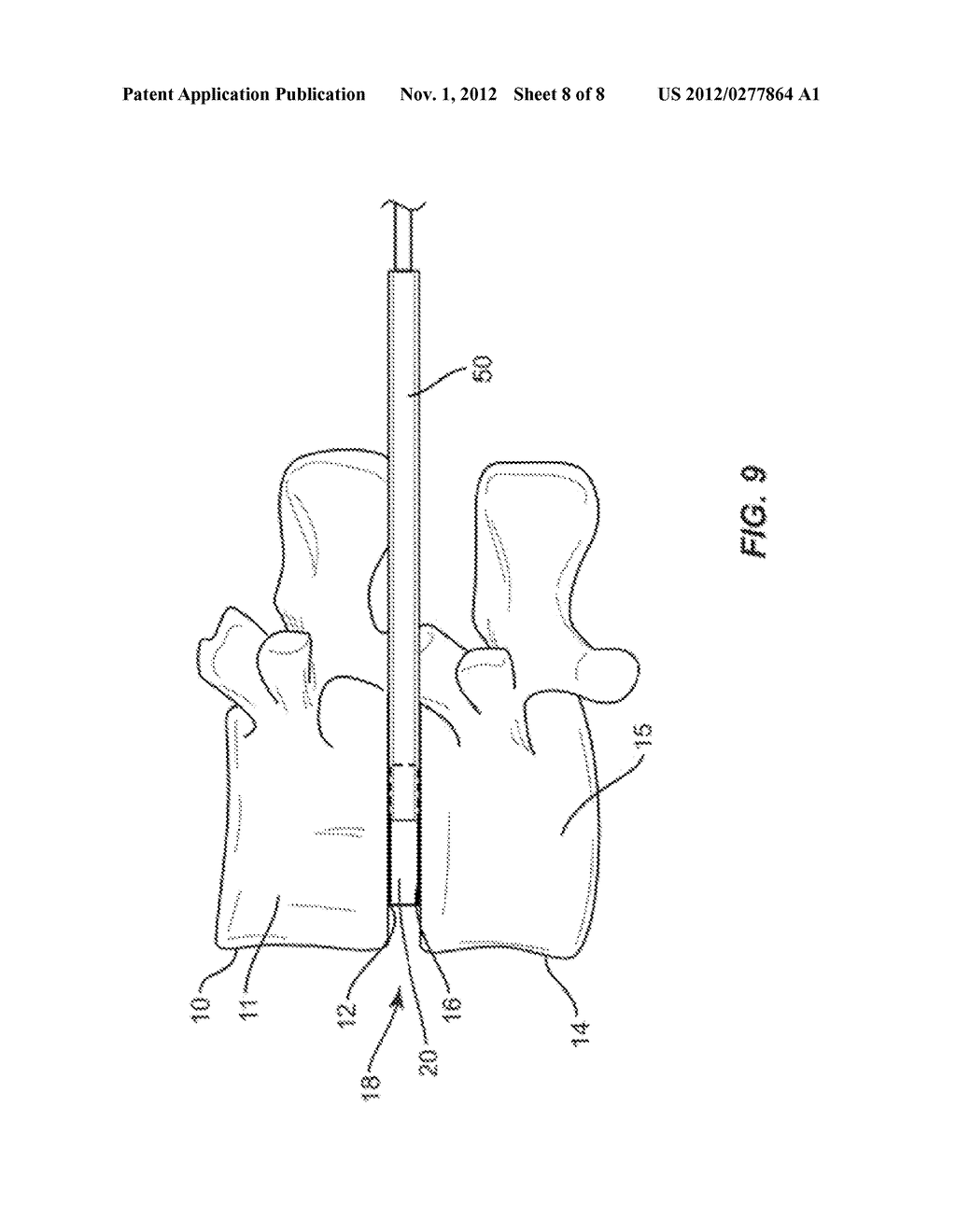 CANNULA ASSEMBLY WITH NON-CIRCULAR PROFILE AND METHOD OF USE - diagram, schematic, and image 09