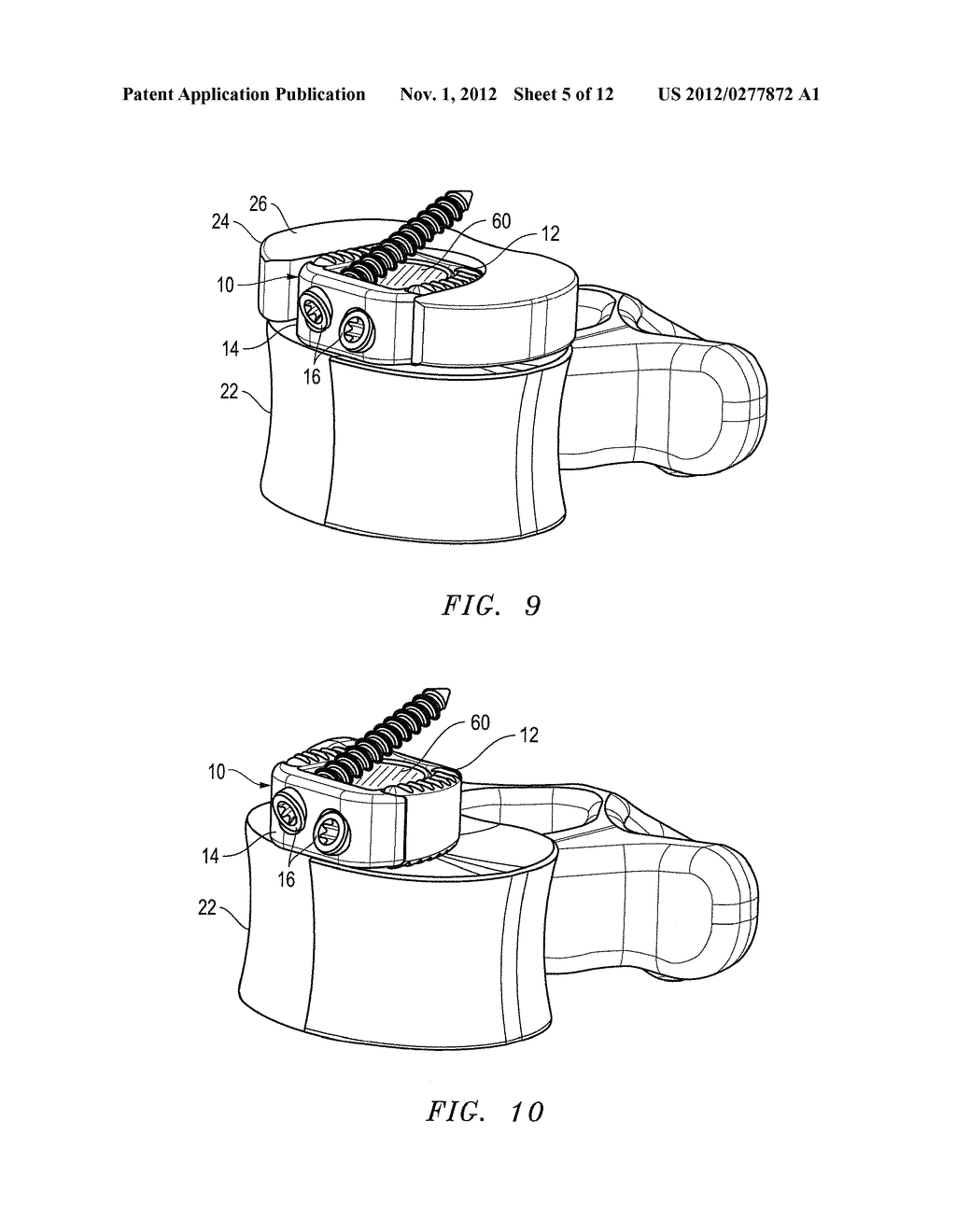 Interbody fusion device with snap on anterior plate and associated methods - diagram, schematic, and image 06