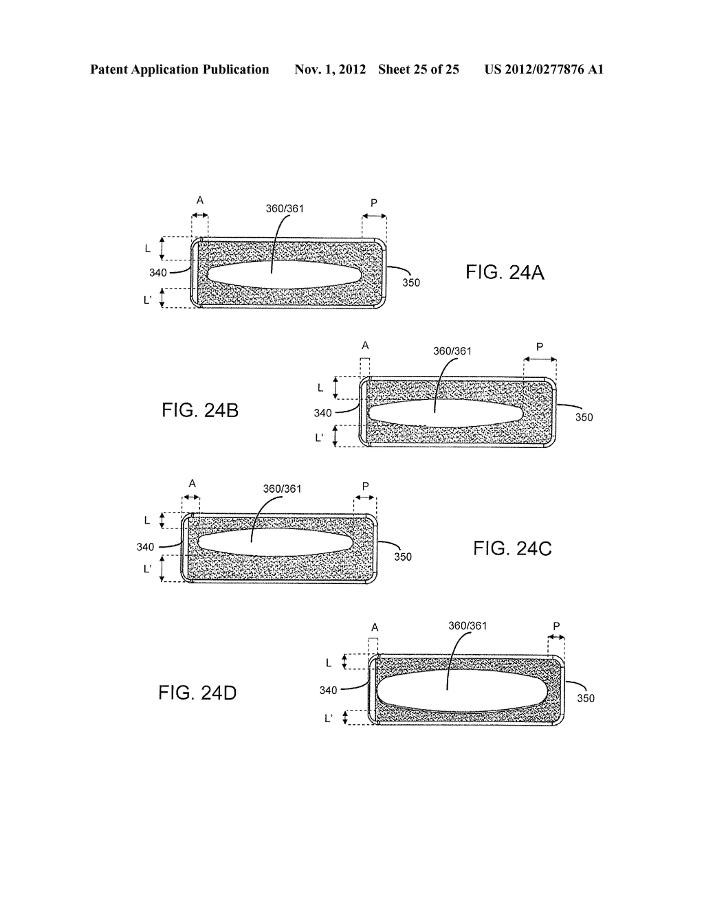 SPINAL IMPLANT HAVING A PASSAGE FOR ENHANCING CONTACT BETWEEN BONE GRAFT     MATERIAL AND CORTICAL ENDPLATE BONE - diagram, schematic, and image 26