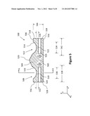 TIBIAL COMPONENT diagram and image