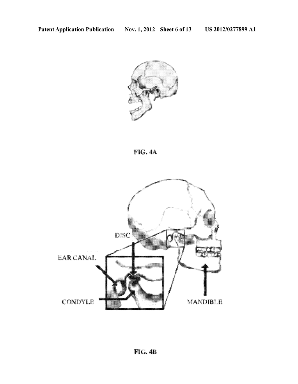 Computer-aided Fabrication Of A Removable Dental Prosthesis - diagram, schematic, and image 07