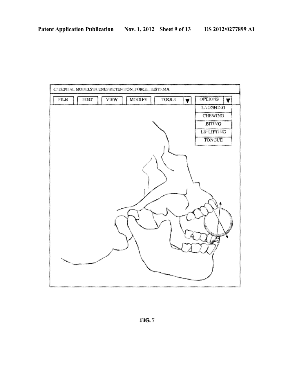 Computer-aided Fabrication Of A Removable Dental Prosthesis - diagram, schematic, and image 10