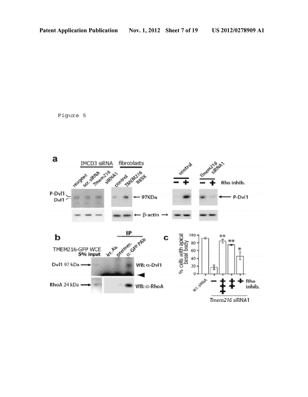 COMPOSITIONS AND METHODS FOR DETERMINING GENETIC POLYMORPHISMS IN THE     TMEM216 GENE - diagram, schematic, and image 08