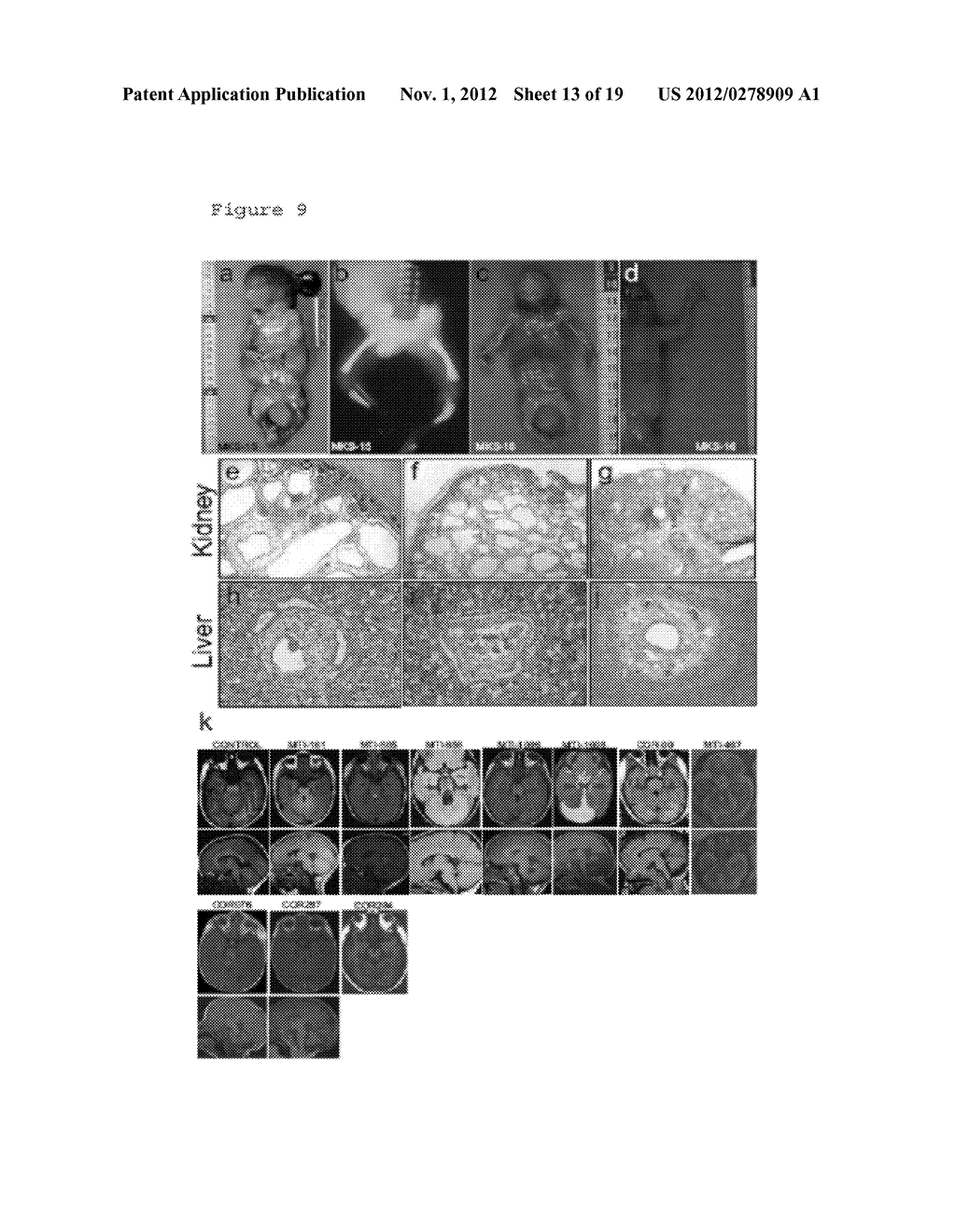 COMPOSITIONS AND METHODS FOR DETERMINING GENETIC POLYMORPHISMS IN THE     TMEM216 GENE - diagram, schematic, and image 14