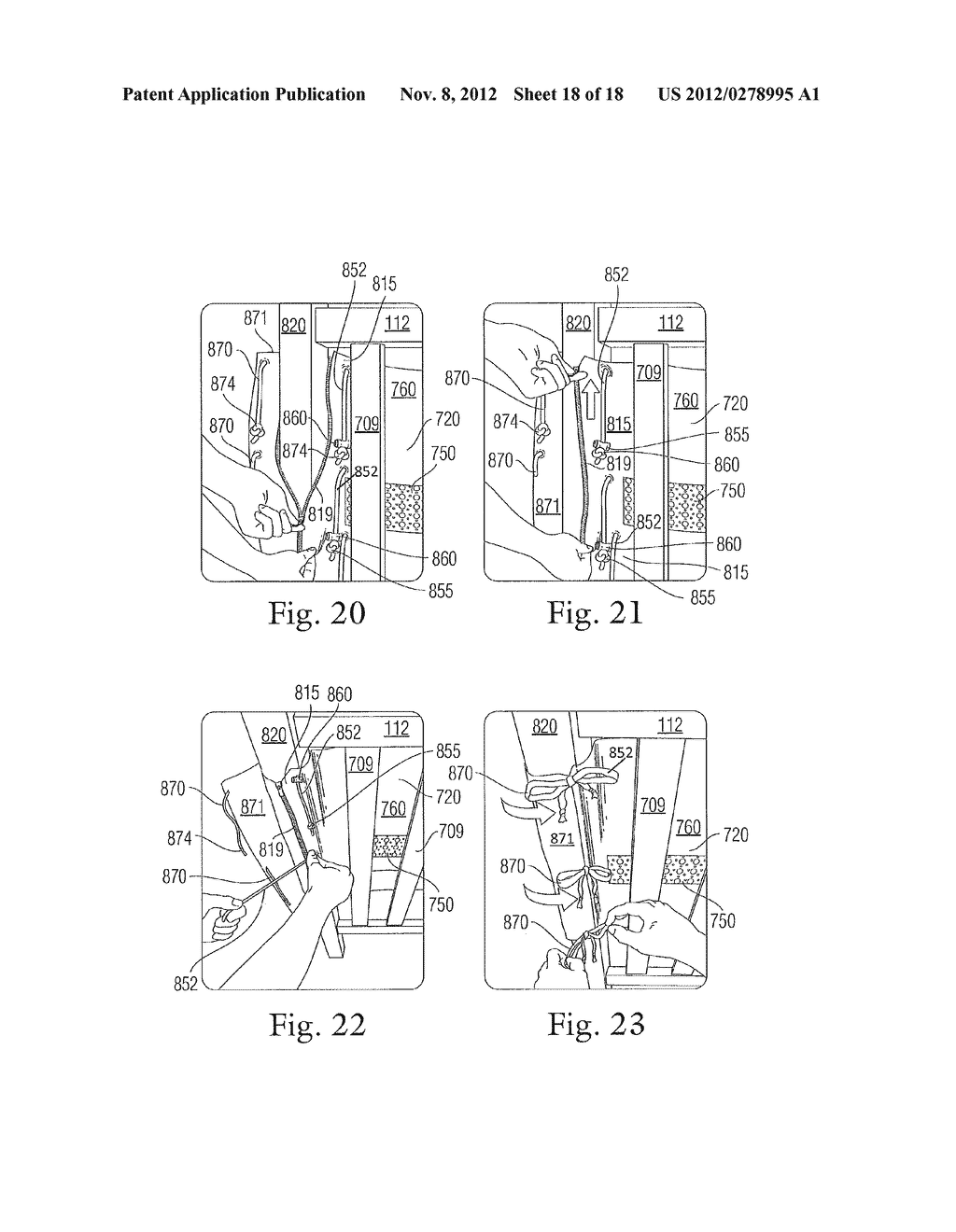 CRIB BUMPER SYSTEM - diagram, schematic, and image 19