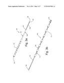 ELECTRICAL STIMULATION LEAD WITH STIFFENERS HAVING VARYING STIFFNESS ZONES diagram and image