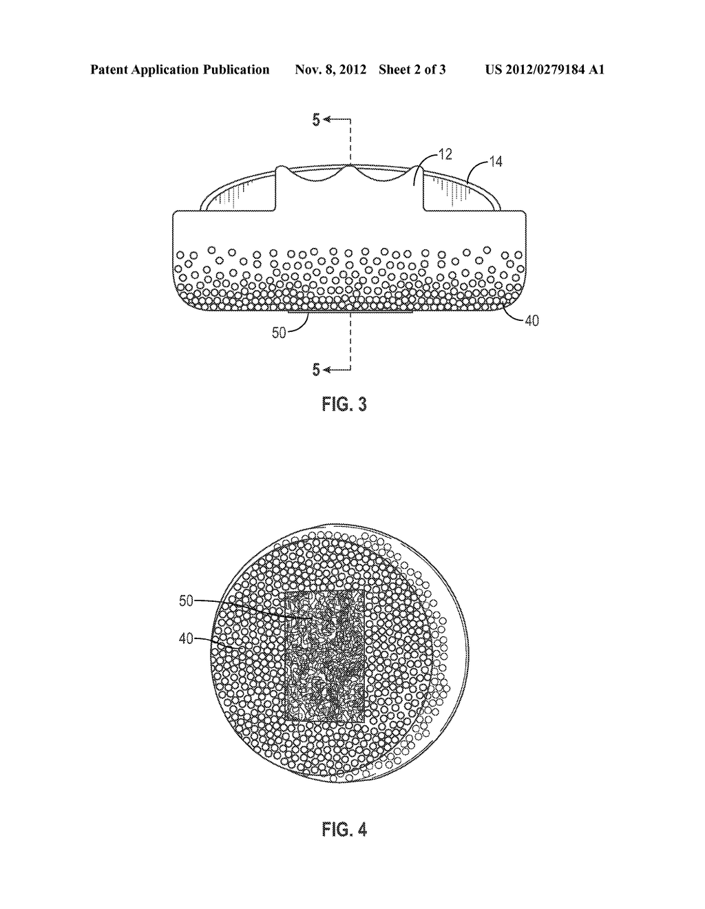 Reduced Weight Equine Orthotic Pad and Method - diagram, schematic, and image 03