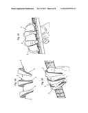 Finger Positioner for Musicians diagram and image