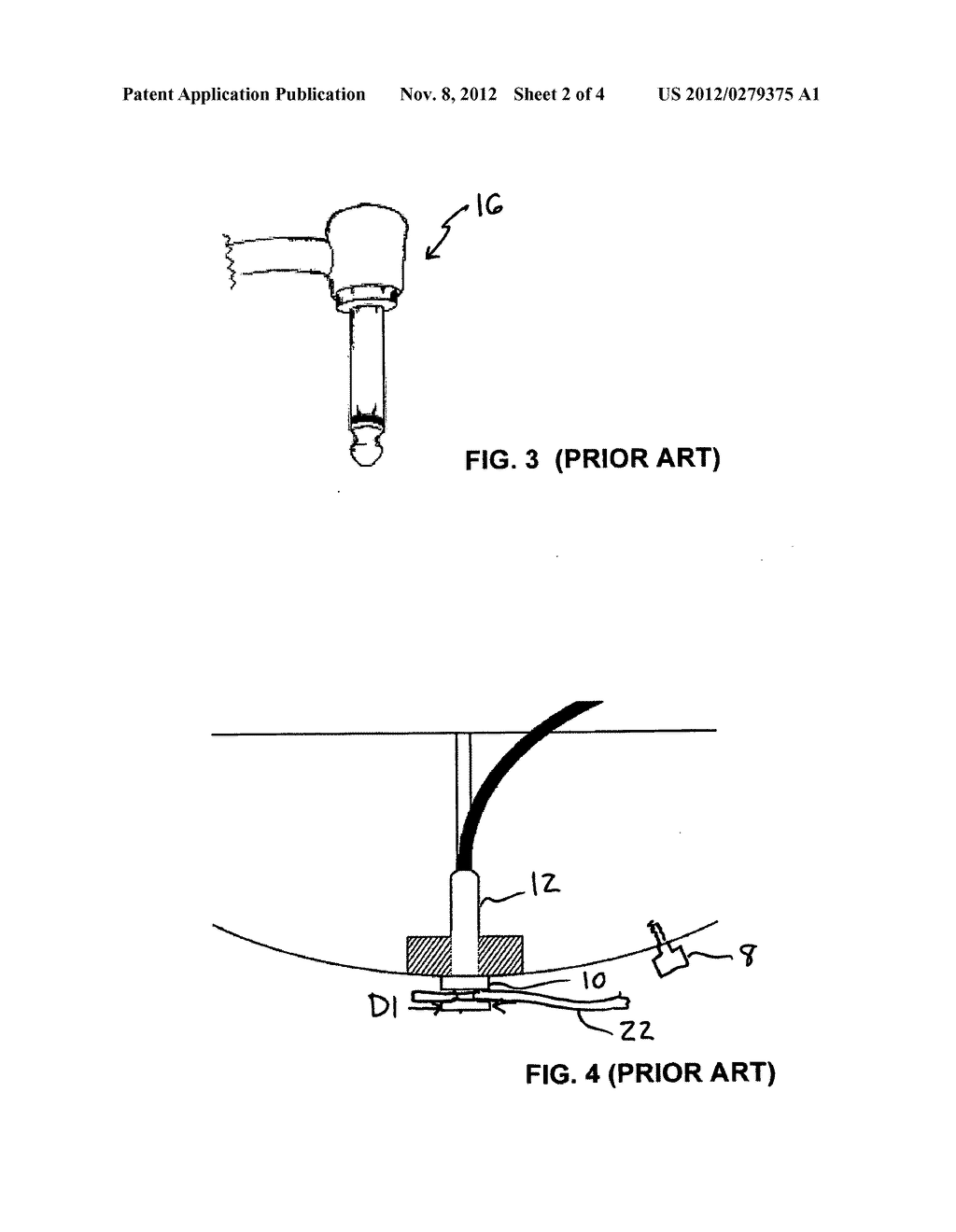 Method and apparatus for securing a guitar strap - diagram, schematic, and image 03