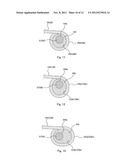 RAILCAR BOGIE diagram and image