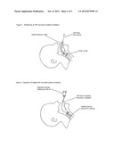 Negative Pressure Intubation Device diagram and image