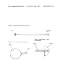 Negative Pressure Intubation Device diagram and image