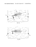 LASER ALIGNMENT DEVICE FOR USE WITH A DRILL RIG diagram and image