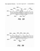 CHEMICALLY-SENSITIVE ARRAY WITH ACTIVE AND REFERENCE SENSORS diagram and image