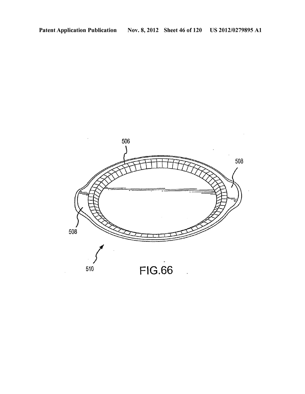 CONTAINER HAVING A RIM OR OTHER FEATURE ENCAPSULATED BY OR FORMED FROM     INJECTION-MOLDED MATERIAL - diagram, schematic, and image 47