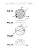 AUTOLOGOUS SURGICAL BONE COLLECTION AND FILTRATION diagram and image