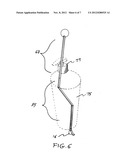 SCOOP SET diagram and image