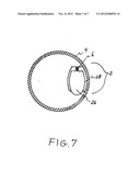 SCOOP SET diagram and image