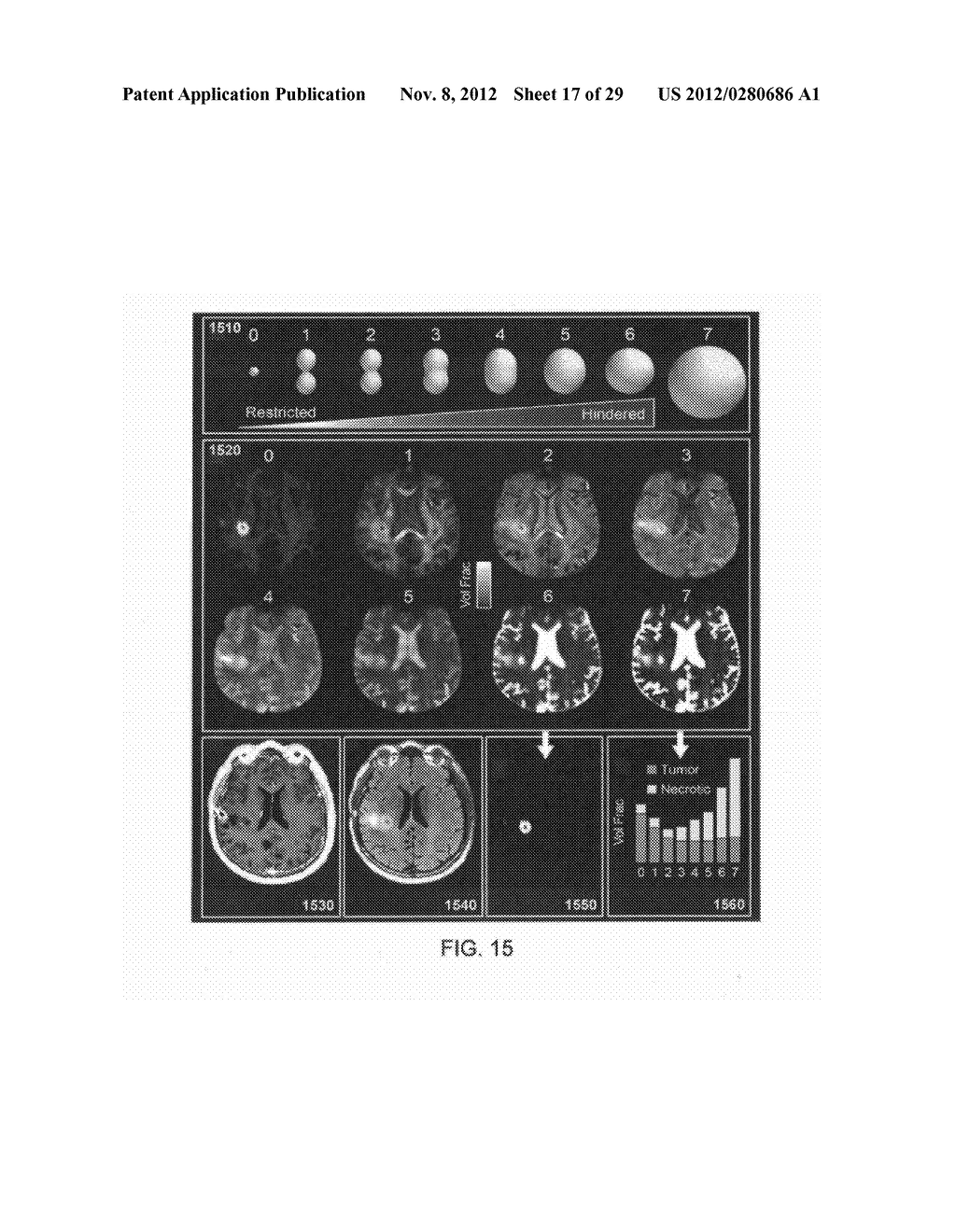 MEASURING BIOLOGICAL TISSUE PARAMETERS USING DIFFUSION MAGNETIC RESONANCE     IMAGING - diagram, schematic, and image 18