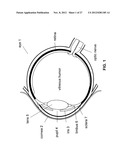 IMAGE-PROCESSOR-CONTROLLED MISALIGNMENT-REDUCTION FOR OPHTHALMIC SYSTEMS diagram and image