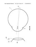 IMAGE-PROCESSOR-CONTROLLED MISALIGNMENT-REDUCTION FOR OPHTHALMIC SYSTEMS diagram and image