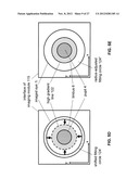IMAGE-PROCESSOR-CONTROLLED MISALIGNMENT-REDUCTION FOR OPHTHALMIC SYSTEMS diagram and image