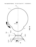 IMAGE-PROCESSOR-CONTROLLED MISALIGNMENT-REDUCTION FOR OPHTHALMIC SYSTEMS diagram and image