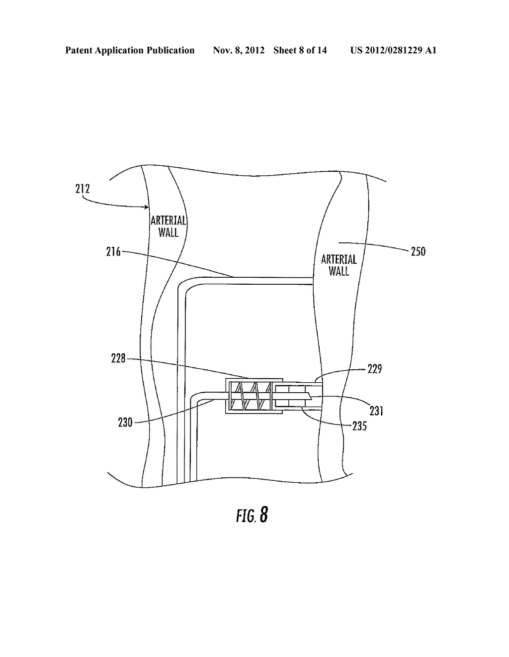 INTERFEROMETRIC MATERIAL SENSING APPARATUS INCLUDING ADJUSTABLE COUPLING     AND ASSOCIATED METHODS - diagram, schematic, and image 09