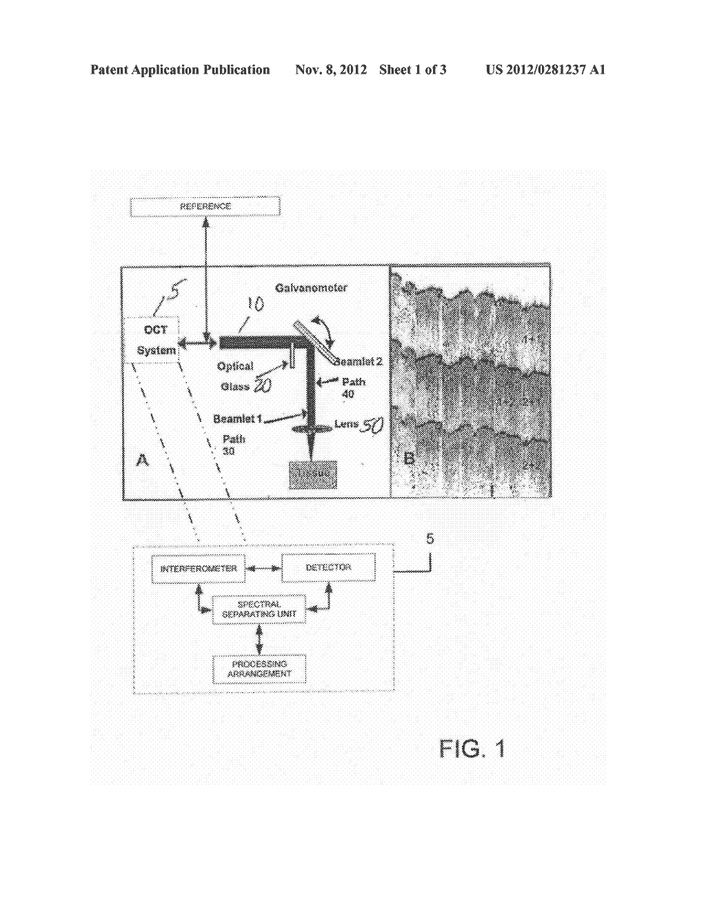 SPECKLE REDUCTION IN OPTICAL COHERENCE TOMOGRAPHY BY PATH LENGTH ENCODED     ANGULAR COMPOUNDING - diagram, schematic, and image 02