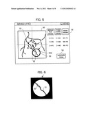 X-RAY IMAGE DIAGNOSING APPARATUS diagram and image