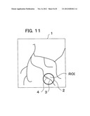 X-RAY IMAGE DIAGNOSING APPARATUS diagram and image