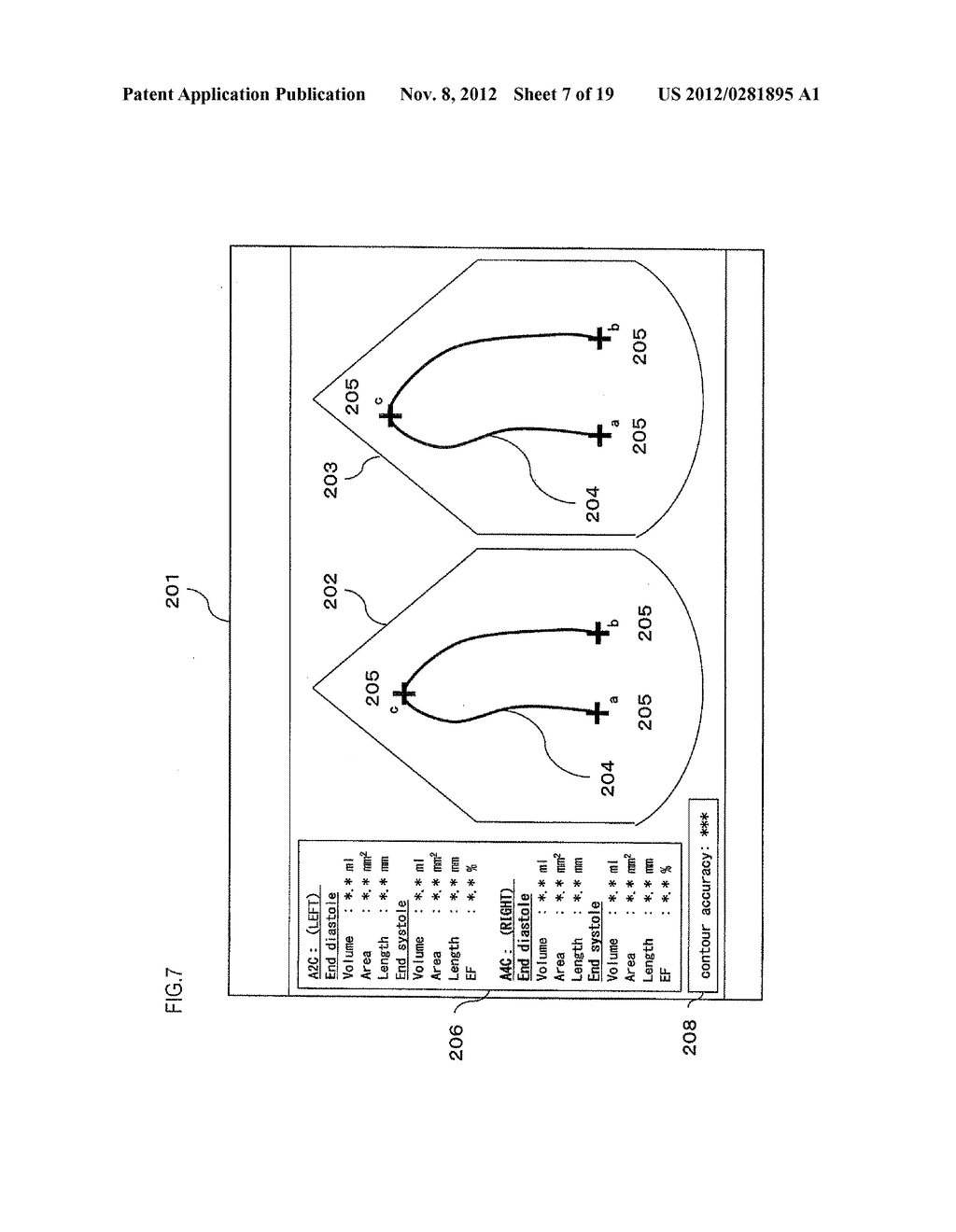 MEDICAL IMAGE DIAGNOSTIC APPARATUS AND MEDICAL IMAGE CONTOUR EXTRACTION     PROCESSING METHOD - diagram, schematic, and image 08