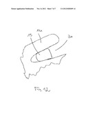 QUICK-FASTENING APPLICATOR CLOSURE diagram and image