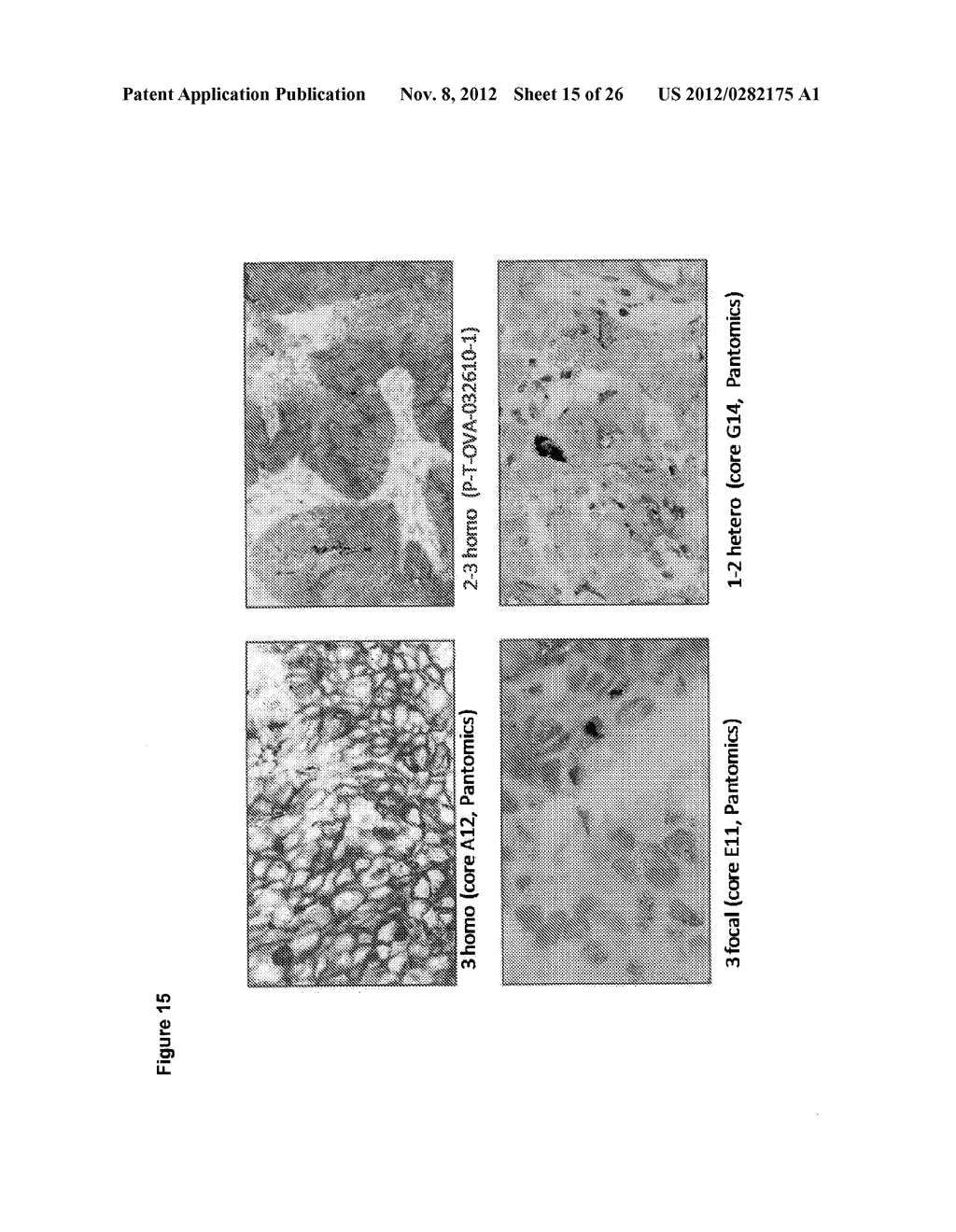 Methods for Increasing Efficacy of FOLR1 Cancer Therapy - diagram, schematic, and image 16